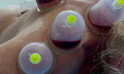 Хиджама арабская Массажист Михаил Черноморск