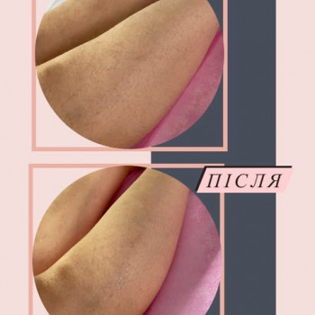 Наталья Полезнюк, Ковель Фото - 6