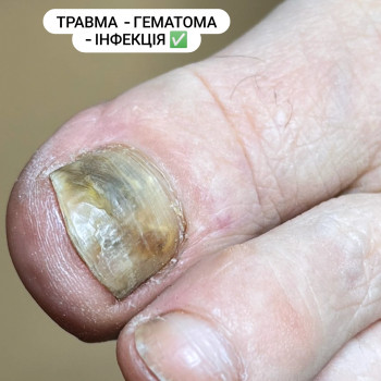 Олена Шибанова, Черкаси Фото - 1