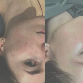 Тетяна Ліщинська, Нововолинськ Фото - 5