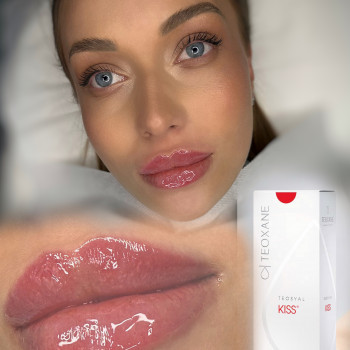 Анна Рутян, Киев Фото - 27