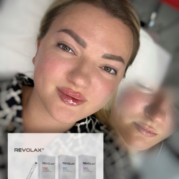 Анна Рутян, Киев Фото - 29