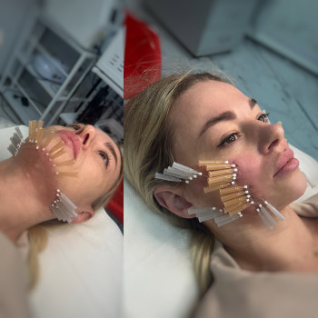 Анна Рутян, Киев Фото - 30