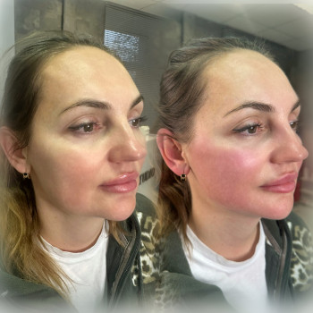 Анна Рутян, Киев Фото - 15