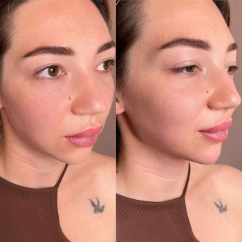 Анна Рутян, Киев Фото - 3