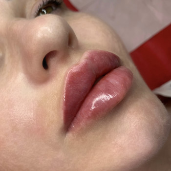 Анна Рутян, Киев Фото - 6