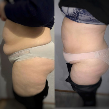 Анна Рутян, Киев Фото - 8