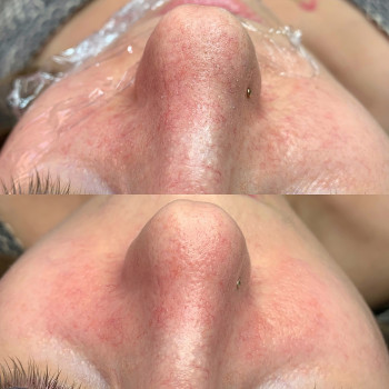 Анна Рутян, Киев Фото - 10