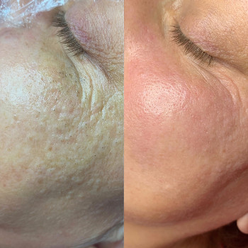 Анна Рутян, Киев Фото - 11