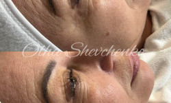  Косметолог-эстетист  Одесса