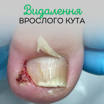 Здорова Стопа, Тернопіль Фото - 5