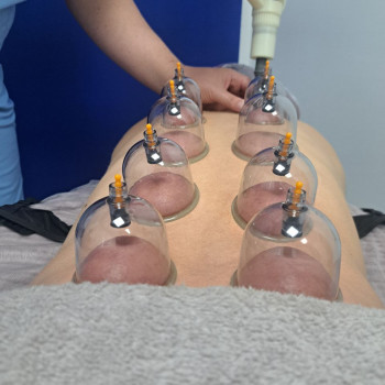 Вакуумний масаж # банки # оздоровлення