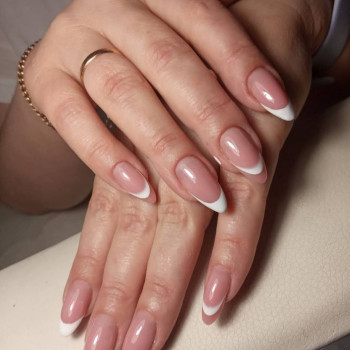 Аліна Дерлеменко, Васильков Фото - 19