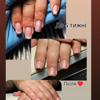 Аліна Дерлеменко, Васильков Фото - 27