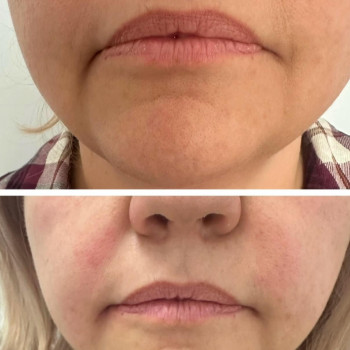 Оксана Сівак, Тернопіль Фото - 5