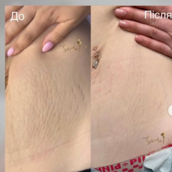 Studio 18, Тернопіль Фото - 5