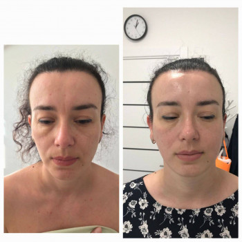 Ольга Сухойван, Дніпро Фото - 3