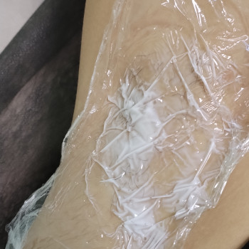 Аппликационная анестезия, фото - мастер депиляции Аня Мельничук