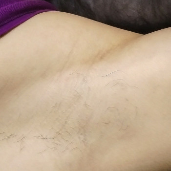 До процедури, фото - мастер депиляции Аня Мельничук