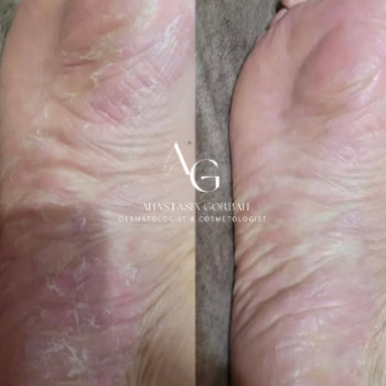 Анастасія Горбань, Тернопіль Фото - 5