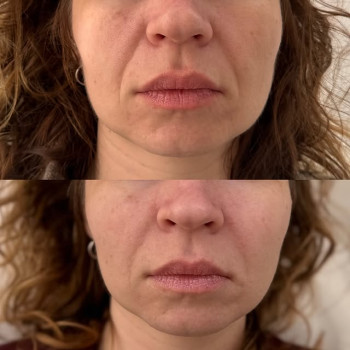 Skin Party, Тернополь Фото - 5