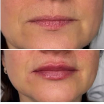 Галина Мелимука, Тернопіль Фото - 5