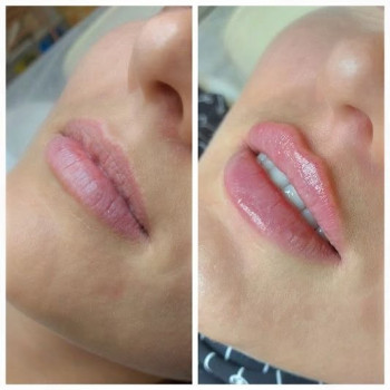 Галина Мелимука, Тернопіль Фото - 6