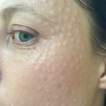 Галина Мелимука, Тернопіль Фото - 7