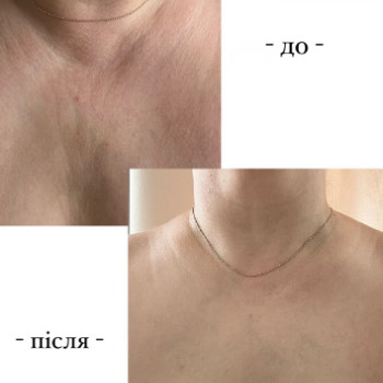 Неля Шмигельська, Тернопіль Фото - 5