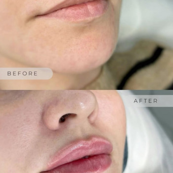 Healthy & beauty club, Киев Фото - 13