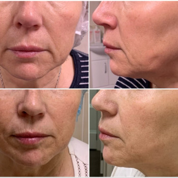 Healthy & beauty club, Киев Фото - 14