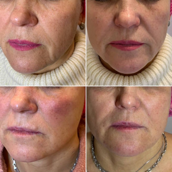 Healthy & beauty club, Киев Фото - 15