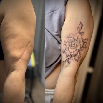 Перекриття шраму тату квіткою