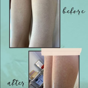 Наталья Самойлова, Тернополь Фото - 5