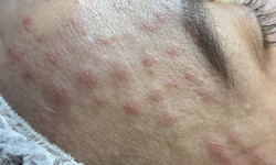  Косметолог-естетист Ольга Хмельницький