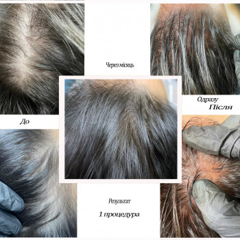 Анна Тіхонова, Киев Фото - 4