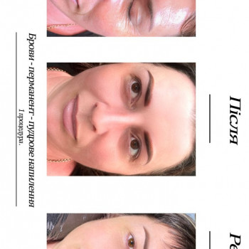 Анна Тіхонова, Киев Фото - 7