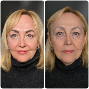 Наталия , Запорожье Фото - 22