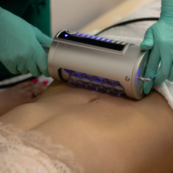 Premium Laser, Стрый Фото - 9