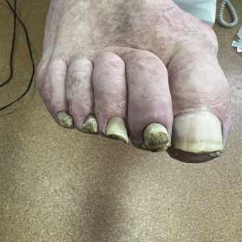 Ірина Абраменко, Кременчуг Фото - 8