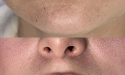 КП губ Врач-косметолог Ксенія Ужгород