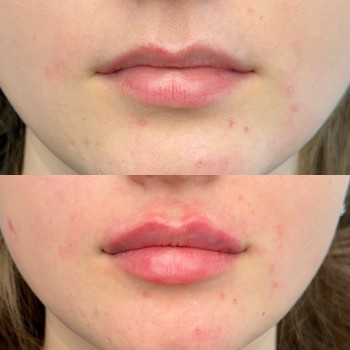 Губи Ужгород