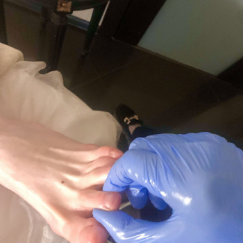 Рефлекторний масаж стоп