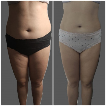 SV Beauty Stydio, Кам'янець-Подільський Фото - 5