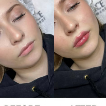 Альбіна Юзвишена, Кам'янець-Подільський Фото - 5