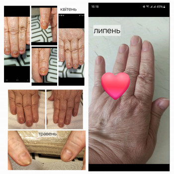 Анжела Кротенко, Кропивницький Фото - 9