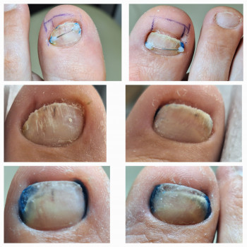 Анжела Кротенко, Кропивницький Фото - 13