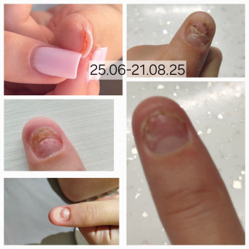 Анжела Кротенко, Кропивницький Фото - 14