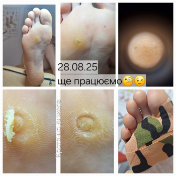 Анжела Кротенко, Кропивницький Фото - 16