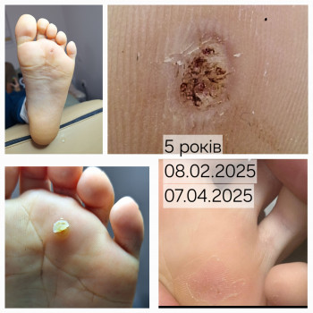 Анжела Кротенко, Кропивницький Фото - 17